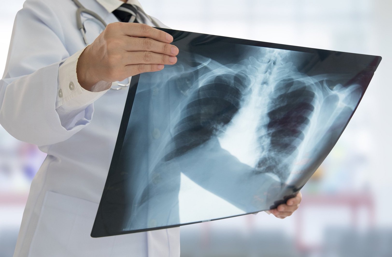 Riaprono le prenotazioni in Radiologia a Carmagnola