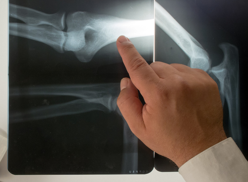 radiologia carmagnola