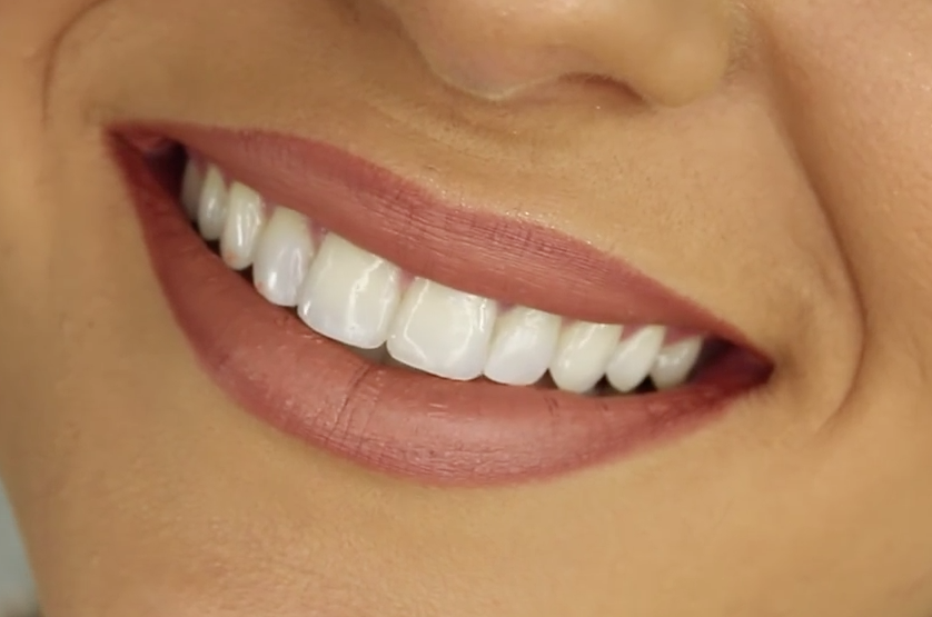Implantologia Dentale