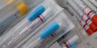 Tamponi gratuiti in Piemonte per studenti e lavorartori in attesa del Green Pass