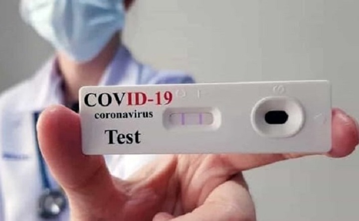 Covid-19: anche a Pasqua continua la lenta risalita dei contagi