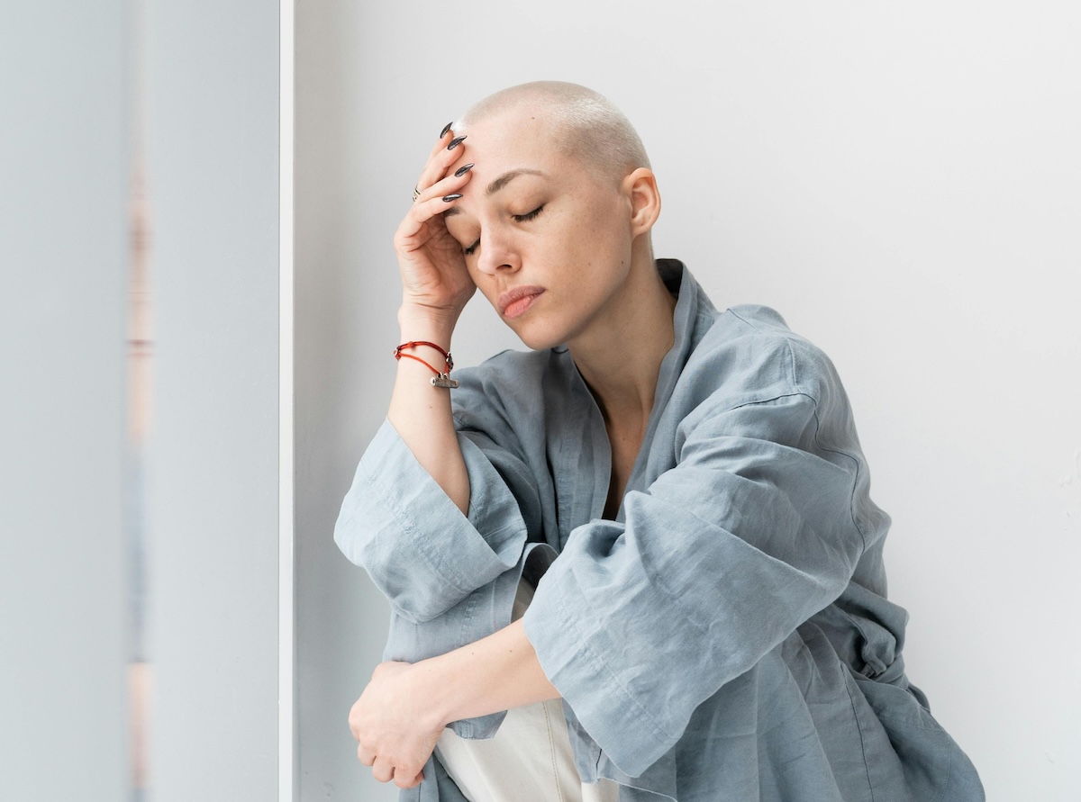alopecia da chemioterapia