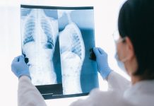 Carmagnola: 20 mila euro per pagare il ticket ai cittadini indigenti carmagnola ticket