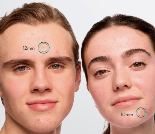 pimple patch